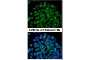 ICC/IF Image Immunofluorescence analysis of paraformaldehyde-fixed mouse ESC D3, using KLF5, antibody at 1:200 dilution. (KLF5 抗体)