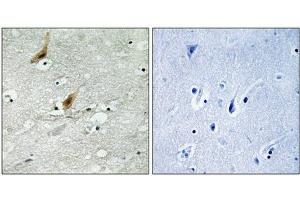 Immunohistochemistry analysis of paraffin-embedded human brain tissue using MSK2 (Phospho-Thr568) antibody. (MSK2 抗体  (pThr568))