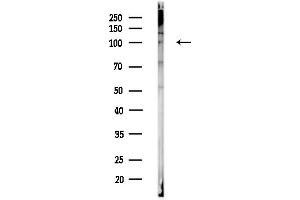 Western blot analysis of lysates from PC12 cells, using CLCN2 Antibody at 1/1000 dilution.