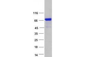 Validation with Western Blot (KLHL14 Protein (Myc-DYKDDDDK Tag))