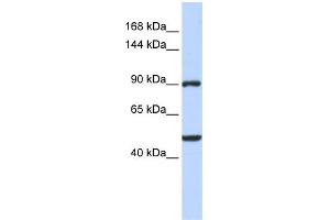 WB Suggested Anti-ZNF217 Antibody Titration:  0. (ZNF217 抗体  (Middle Region))