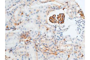 ABIN6267250 at 1/100 staining mouse kidney tissue sections by IHC-P.