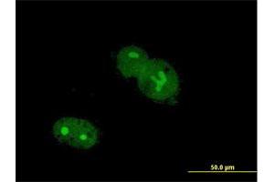 Immunofluorescence of purified MaxPab antibody to ZNF32 on Hs 181. (ZNF32 抗体  (AA 1-273))