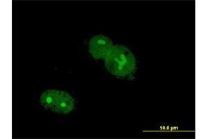 Immunofluorescence of purified MaxPab antibody to ZNF32 on Hs 181.