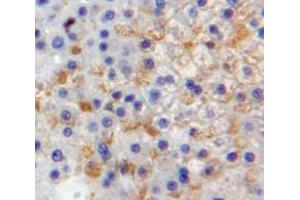 Used in DAB staining on fromalin fixed paraffin-embedded Liver tissue (Selectin E/CD62e 抗体  (AA 108-238))
