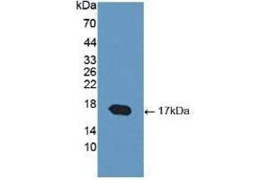 Detection of Recombinant COMP, Human using Polyclonal Antibody to Cartilage Oligomeric Matrix Protein (COMP) (COMP 抗体  (AA 123-240))
