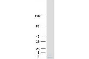 Western Blotting (WB) image for Family with Sequence Similarity 229, Member B (FAM229B) protein (Myc-DYKDDDDK Tag) (ABIN2714144)