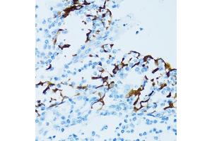 Immunohistochemistry of paraffin-embedded human tonsil using CTSE antibody (ABIN5971444) at dilution of 1/100 (40x lens). (Cathepsin E 抗体)