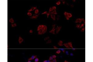 Immunofluorescence analysis of HeLa cells using CD40L Polyclonal Antibody at dilution of 1:100. (CD40 Ligand 抗体)