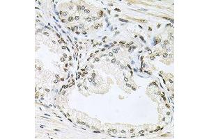 Immunohistochemistry (Paraffin-embedded Sections) (IHC (p)) image for anti-Mitogen-Activated Protein Kinase 8 (MAPK8) (AA 245-345) antibody (ABIN3020887)