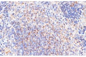 Immunohistochemistry of paraffin-embedded Rat spleen using PDGFR beta Polyclonal Antibody at dilution of 1:100 (40x lens). (PDGFRB 抗体)
