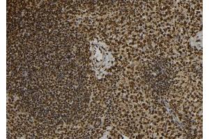 ABIN6277088 at 1/100 staining Mouse spleen tissue by IHC-P. (Progesterone Receptor 抗体  (Internal Region))