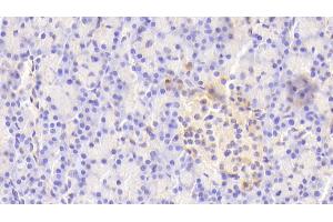 Immunohistochemistry (IHC) image for anti-Protein Tyrosine Phosphatase, Receptor Type, N (PTPRN) (AA 35-185) antibody (ABIN7444055)