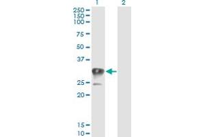 Western Blot analysis of CCS expression in transfected 293T cell line by CCS monoclonal antibody (M03), clone 1E2. (Superoxide dismutase copper chaperone 抗体  (AA 175-274))