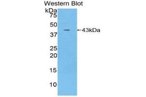 Western Blotting (WB) image for anti-Interleukin 12 Receptor, beta 2 (IL12RB2) (AA 559-647) antibody (ABIN1859338) (IL12RB2 抗体  (AA 559-647))