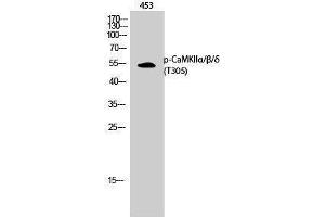 Western Blotting (WB) image for anti-CaMKIIalpha/beta/delta (pThr305) antibody (ABIN3182178) (CaMKIIalpha/beta/delta (pThr305) 抗体)