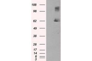 Image no. 5 for anti-Lipase, Endothelial (LIPG) antibody (ABIN1499166) (LIPG 抗体)