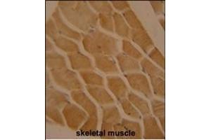 LMOD2 antibody (N-term) (ABIN654322 and ABIN2844103) immunohistochemistry analysis in formalin fixed and paraffin embedded human skeletal muscle followed by peroxidase conjugation of the secondary antibody and DAB staining. (Leiomodin 2 抗体  (N-Term))