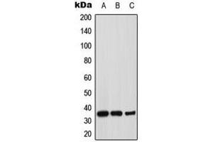 Western blot analysis of Syntaxin 1A expression in MCF7 (A), mouse brain (B), rat brain (C) whole cell lysates. (STX1A 抗体  (N-Term))