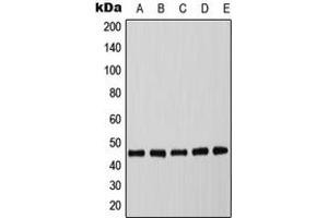 Western blot analysis of C/EBP alpha (pT226) expression in MCF7 EGF-treated (A), mouse spleen (B), mouse liver (C), rat spleen (D), rat liver (E) whole cell lysates. (CEBPA 抗体  (pSer226))