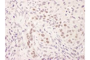 anti-GR (AA 150-200) antibody