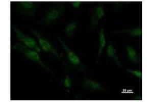 Immunostaining analysis in HeLa cells. (PSMC5 抗体)
