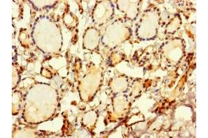 Immunohistochemistry of paraffin-embedded human thyroid tissue using ABIN7169648 at dilution of 1:100 (SRP19 抗体  (AA 2-144))