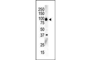 Western blot analysis of anti-PKCnu C-term Pab in NCI-H460 cell lysate. (PRKD3 抗体  (C-Term))