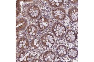 Immunohistochemical staining of human colon with DMRTA2 polyclonal antibody  shows moderate cytoplasmic positivity in glandular cells at 1:20-1:50 dilution. (DMRTA2 抗体)