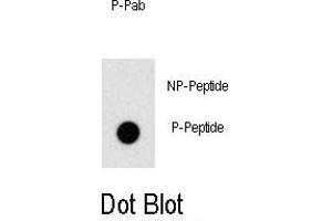 Dot blot analysis of anti-Phospho-ZBTB16-p Antibody (ABIN389958 and ABIN2839759) on nitrocellulose membrane. (ZBTB16 抗体  (pTyr334))