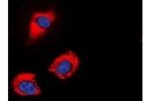 Immunofluorescent analysis of GAP43 (pS41) staining in SHSY5Y cells. (GAP43 抗体  (N-Term, pSer41))