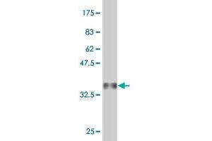Western Blot detection against Immunogen (36. (PET112L 抗体  (AA 466-556))