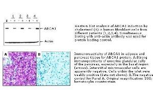 Immunohistochemistry (IHC) image for anti-ATP-Binding Cassette, Sub-Family A (ABC1), Member 1 (ABCA1) antibody (ABIN187475)