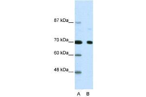WB Suggested Anti-NCOR2  Antibody Titration: 2. (NCOR2 抗体  (N-Term))