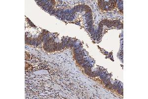 IHC analysis of SBP/SELENBP1 using anti-SBP/SELENBP1 antibody (ABIN7600755). (SELENBP1 抗体  (AA 23-462))