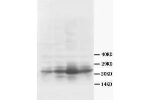 Western Blotting (WB) image for anti-Growth Associated Protein 43 (GAP43) antibody (ABIN1107311) (GAP43 抗体)