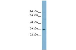 WB Suggested Anti-DNASE1  Antibody Titration: 0. (DNASE1 抗体  (N-Term))