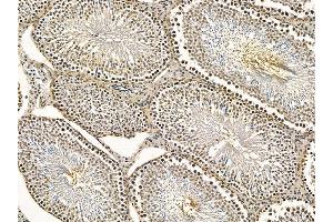 ABIN7095262 and ABIN7099319 at 1/100 staining rat testis tissue by IHC-P.