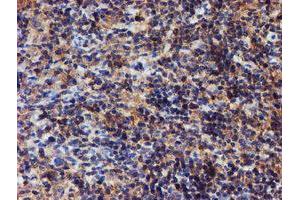 Image no. 13 for anti-Iduronate 2-Sulfatase (IDS) antibody (ABIN1498797)