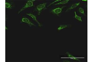 Immunofluorescence (IF) image for anti-Dihydrolipoamide S-Succinyltransferase (E2 Component of 2-Oxo-Glutarate Complex) (DLST) (AA 1-453) antibody (ABIN947795)
