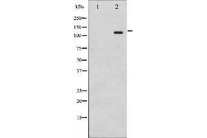 Western blot analysis of Retinoblastoma phosphorylation expression in serum treated K562 whole cell lysates,The lane on the left is treated with the antigen-specific peptide. (Retinoblastoma 1 抗体  (pSer795))