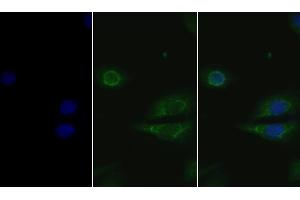 Detection of GSN in Human Hela cell using Polyclonal Antibody to Gelsolin (GSN) (Gelsolin 抗体  (AA 674-782))