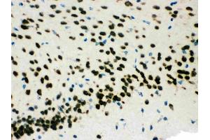 Anti-SMN1/2 Picoband antibody, (ABIN3043933),IHC(P)IHC(P): Mouse Brain Tissue