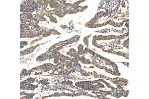 IHC analysis of TTK using anti-TTK antibody (ABIN7601844).