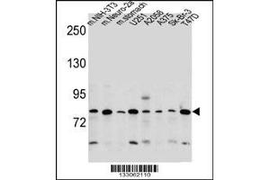 Western blot analysis in mouse NIH-3T3,Neuro-2a cell line and mouse stomach tissue and U251,A2058,A375,Sk-Br-3,T47D cell line lysates (35ug/lane). (DCBLD2 抗体  (C-Term))