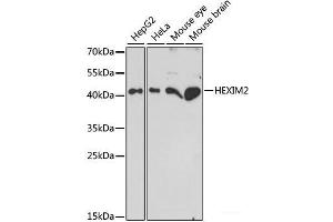 Western blot analysis of extracts of various cell lines using HEXIM2 Polyclonal Antibody at dilution of 1:1000. (HEXIM2 抗体)