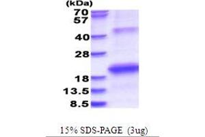 SDS-PAGE (SDS) image for Hepatitis C Virus NS5b (HCV NS5b) (AA 2634-2752) protein (His tag) (ABIN5853698)