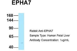 Host: Rabbit  Target Name: EPHA7  Sample Tissue: Human Fetal Liver  Antibody Dilution: 1.