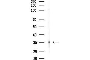 anti-ZFP36 Ring Finger Protein-Like 1 (ZFP36L1) (Internal Region) antibody