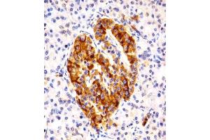 Immunohistochemical analysis of paraffin-embedded H. (MAPK10 抗体  (N-Term))
